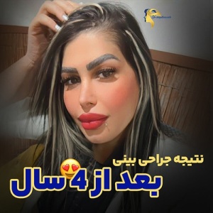 د.مجدی-نسب.-جراحی-بینی3
