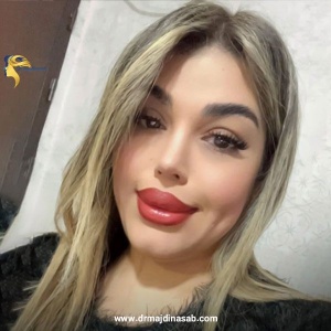 Rhinoplasty-19