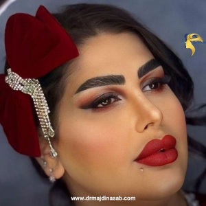 Rhinoplasty-21