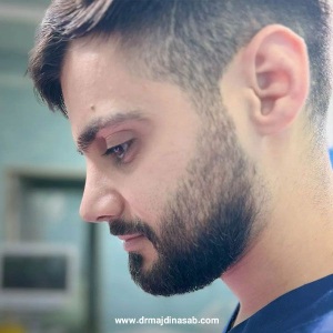 Rhinoplasty-24