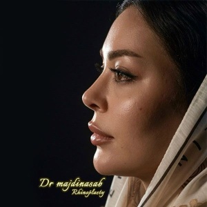 Rhinoplasty-49