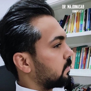 Rhinoplasty-54
