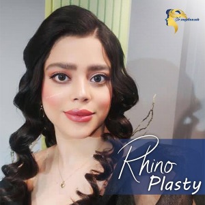 rhinoplasty7