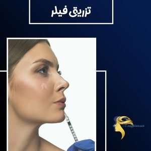 تزریق فیلر - دکتر نیلوفر مجدی نسب