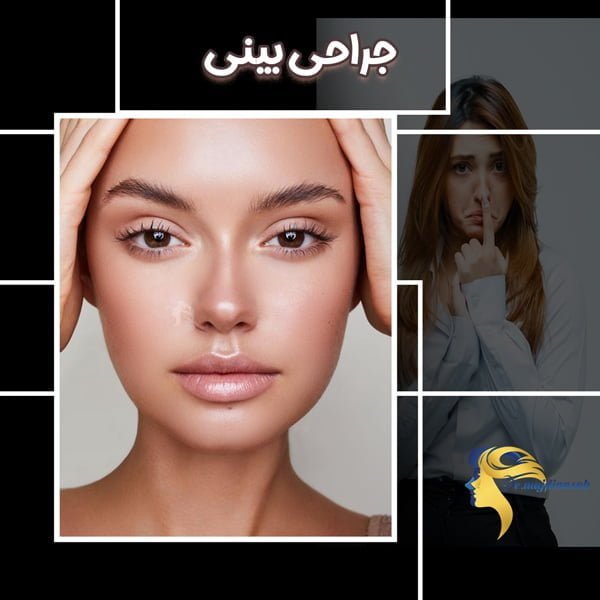 جراحی بینی - دکتر نیلوفر مجدی نسب