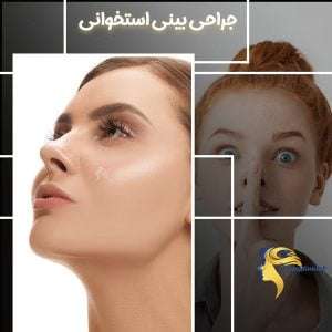 جراحی بینی استخوانی _ دکتر نیلوفر مجدی نسب