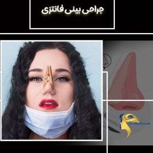 عکس جراحی بینی فانتزی
