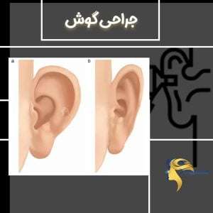 جراحی گوش - دکتر نیلوفر مجدی نسب