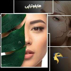 هایفوتراپی - دکتر نیلوفر مجدی نسب