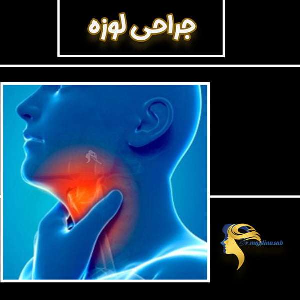 جراحی لوزه - دکتر نیلوفر مجدی نسب