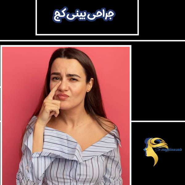 جراحی بینی کج - دکتر نیلوفر مجدی نسب