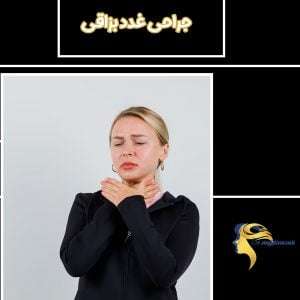 جراحی غدد بزاقی - دکتر نیلوفر مجدی نسب