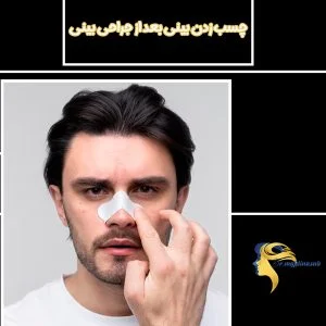 چسب زدن بینی بعد از جراحی بینی- دکتر نیلوفر مجدی نسب