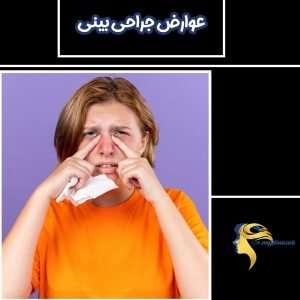 عوارض جراحی بینی - دکتر نیلوفر مجدی نسب