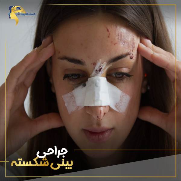 جراحی بینی شکسته