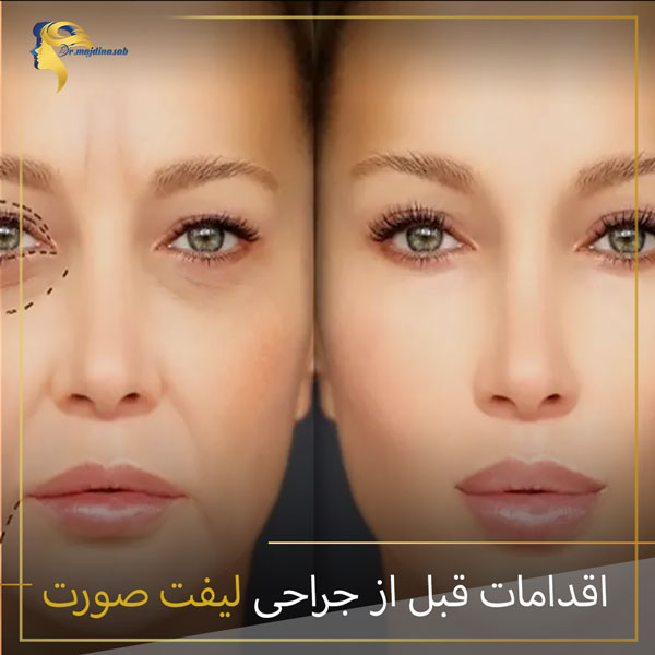 اقدامات قبل از جراحی لیفت صورت : دکتر نیلوفر مجدی نسب