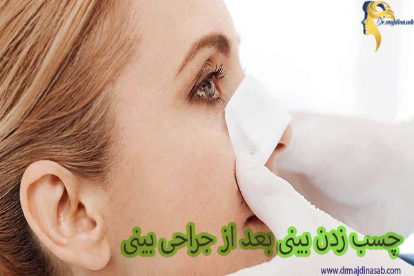 چسب زدن بعد از جراحی بینی - دکتر نیلوفر مجدی نسب