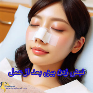 نبض زدن بینی بعد از عمل - دکتر نیلوفر مجدی نسب