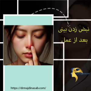 نبض زدن بینی بعد از عمل - دکتر نیلوفر مجدی نسب