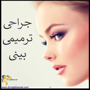 جراحی ترمیمی بینی - دکتر نیلوفر مجدی نسب