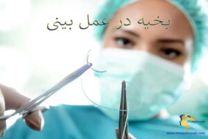 بخیه در عمل بینی - دکتر نیلوفر مجدی نسب