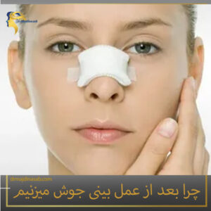 چرا بعد از عمل بینی جوش میزنیم؟ دکتر نیلوفر مجدی نسب
