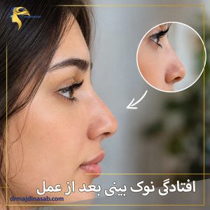 افتادگی نوک بینی بعد از عمل + دکتر نیلوفر مجدی نسب