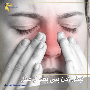 نبض زدن بینی بعد از عمل + دکتر نیلوفر مجدی نسب