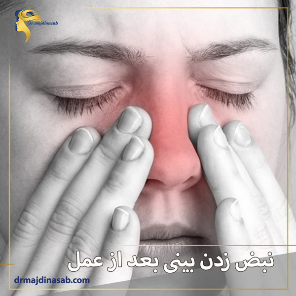 نبض زدن بینی بعد از عمل + دکتر نیلوفر مجدی نسب