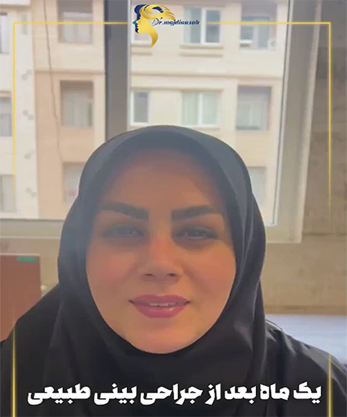 عکس جراحی بینی طبیعی - دکتر نیلوفر مجدی نسب