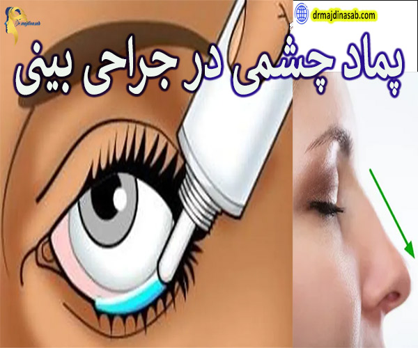 پماد چشمی در جراحی بینی - دکتر نیلوفر مجدی نسب