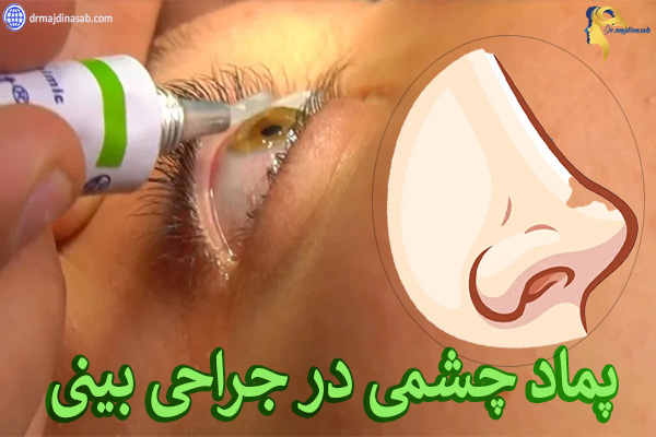 پماد چشمی در جراحی بینی - دکتر نیلوفر مجدی نسب