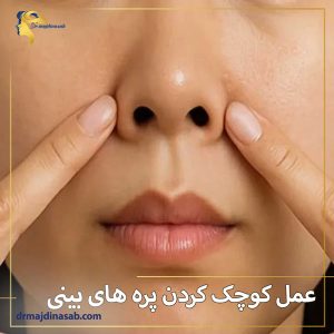عمل کوچک کردن پره های بینی + دکتر نیلوفر مجدی نسب