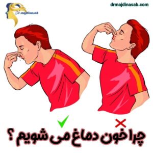 عکس چرا خون دماغ می شویم ؟ - دکتر نیلوفر مجدی نسب