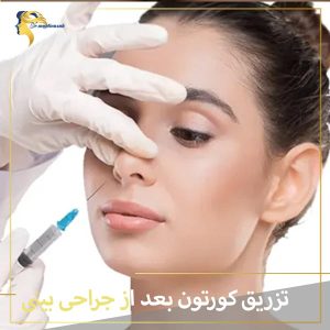 تزریق کورتون بعد از جراحی بینی