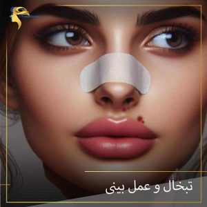 تبخال و عمل بینی