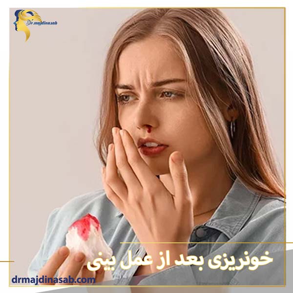 خونریزی بعد از عمل بینی - دکتر میلوفر مجدی نسب