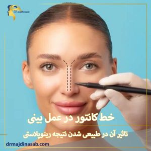 خط کانتور در عمل بینی