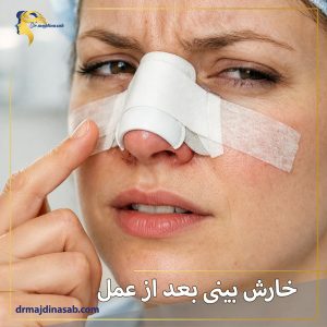 خارش بینی بعد از عمل + دکتر نیلوفر مجدی نسب