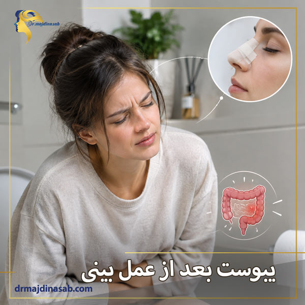 یبوست بعد از عمل بینی + دکتر نیلوفر مجدی نسب
