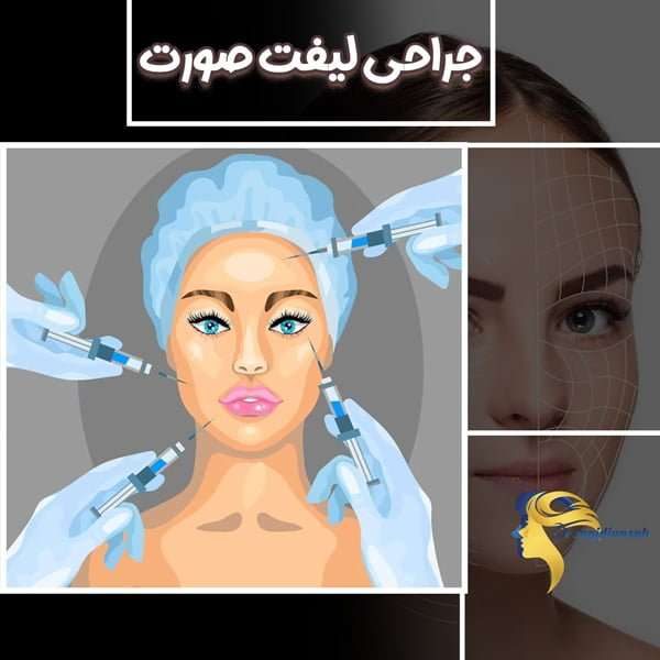 جراحی-لیفت-صورت جراحی لیفت صورت - دکتر نیلوفر مجدی نسب
